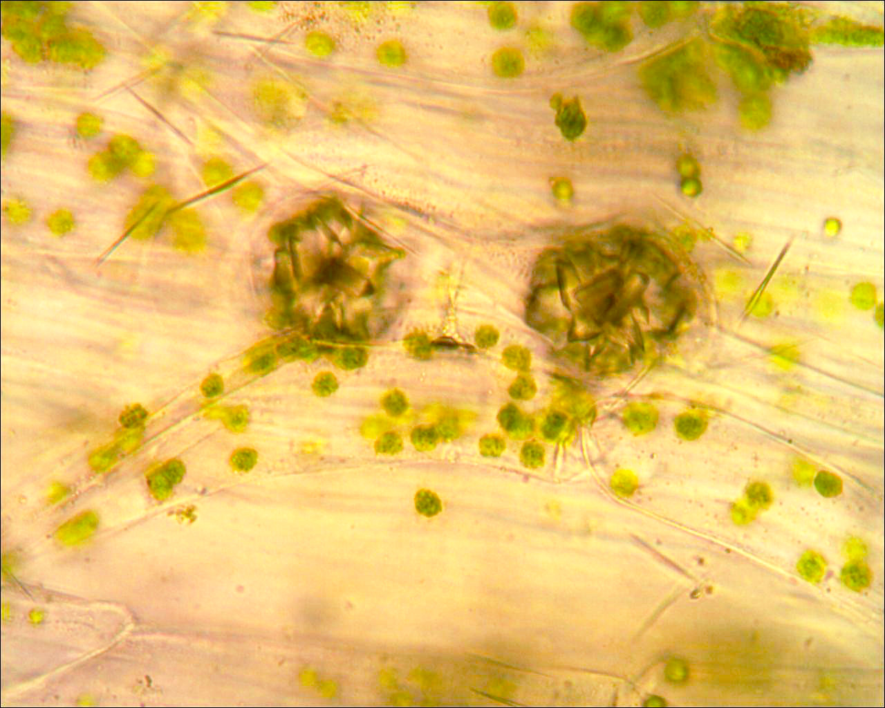 Druse (cristalli di ossalato di calcio) in foglia di Dieffenbachia