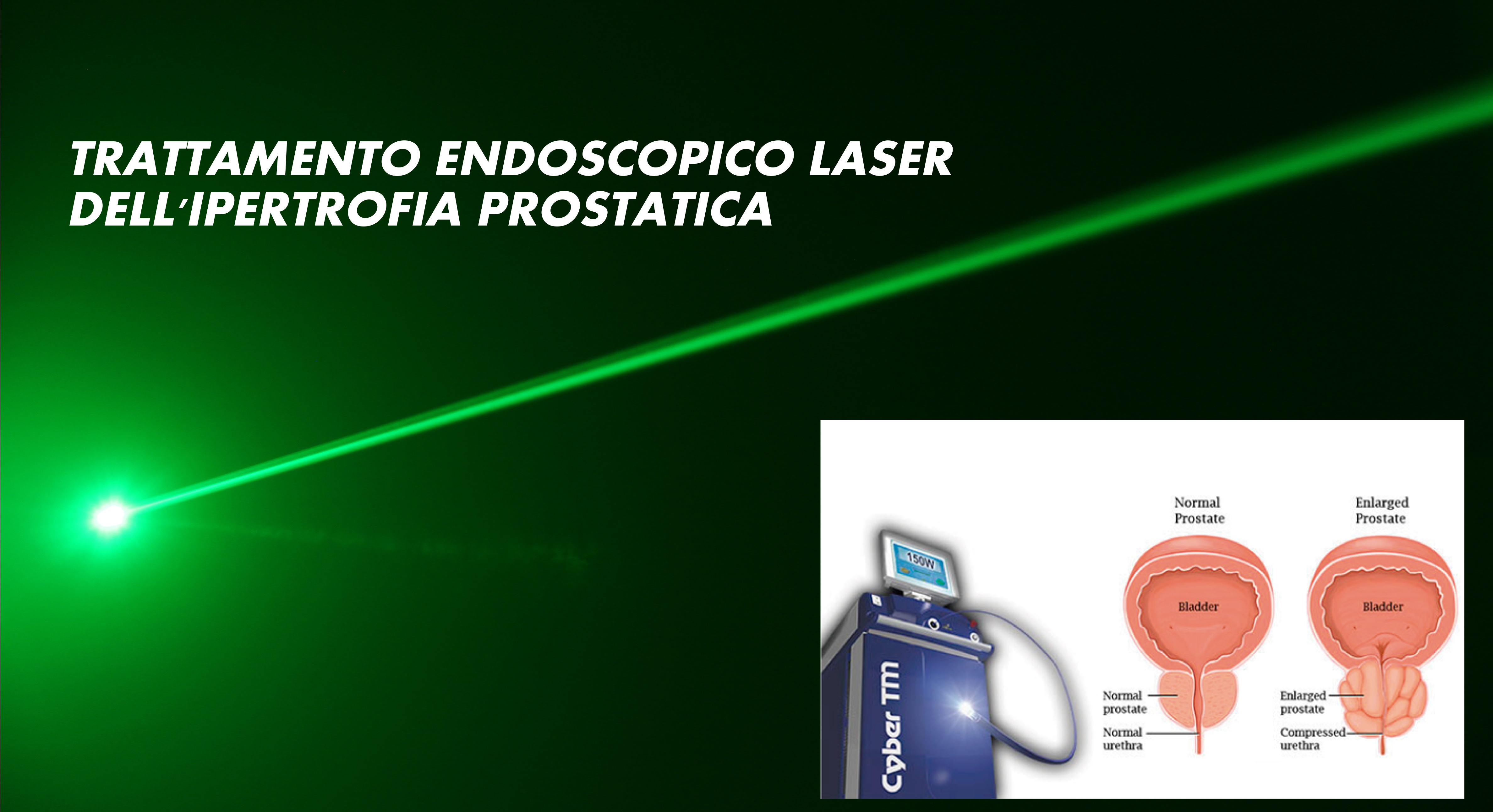 Intervento prostata laser, olasz - magyar szótár