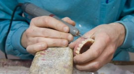 Riparazione protesi dentale,dentiera