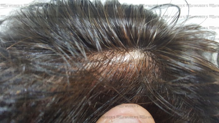 BILBAO protesi capelli veri ad innesto iniettati   --  OFFERTA 2 PROTESI CAPELLI