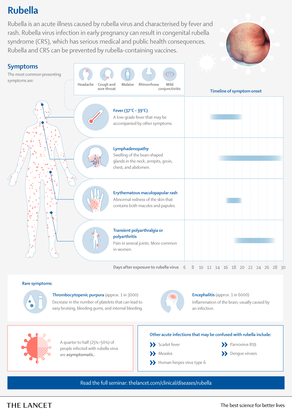 Rubella-1png