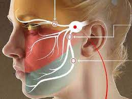 Stimolazione magnetica periferica ripetitiva (rPMS) in soggetti con emicrania ed effetti sulla muscolatura scheletrica