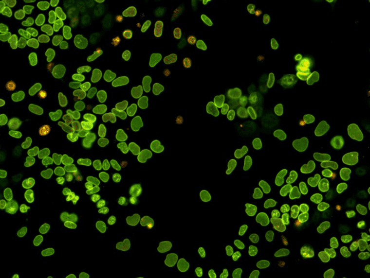 I PEMF promuovono la produzione da parte dell'organismo del proprio ATP, attivando le difese antiossidanti cellulari in tutto il corpo.