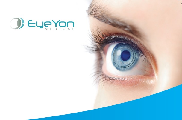 Lente Hyper-CL™ EyeYon Medical