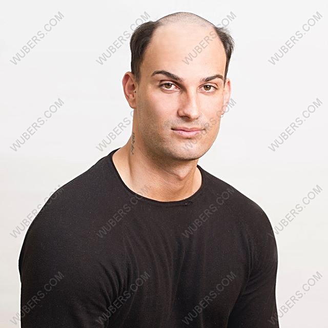 Infoltimento capelli uomo con protesi capelli veri WUBER´S