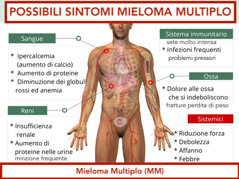 mieloma-multiplo-sintomipng