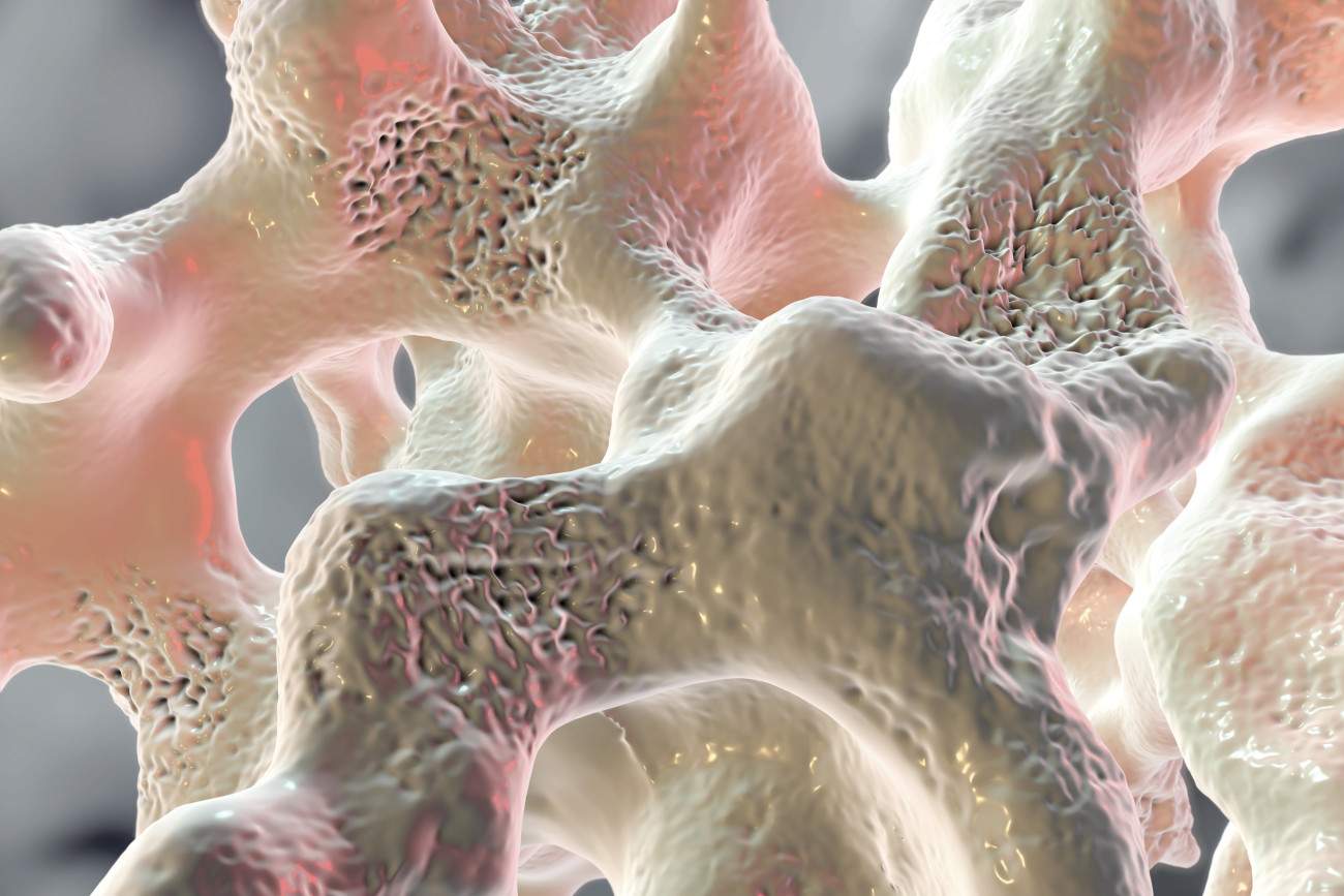 L'effetto dei campi elettromagnetici pulsati sull'adiposità midollare nelle donne in postmenopausa con osteopenia