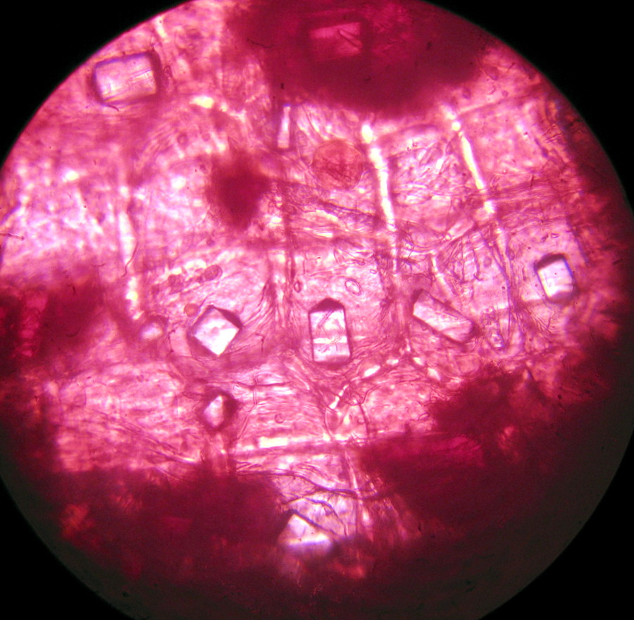 Stiloidi (cristalli di ossalato di calcio) in catafillo di cipolla