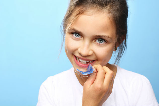 Ortodonzia: quale apparecchio per i denti storti dei bambini