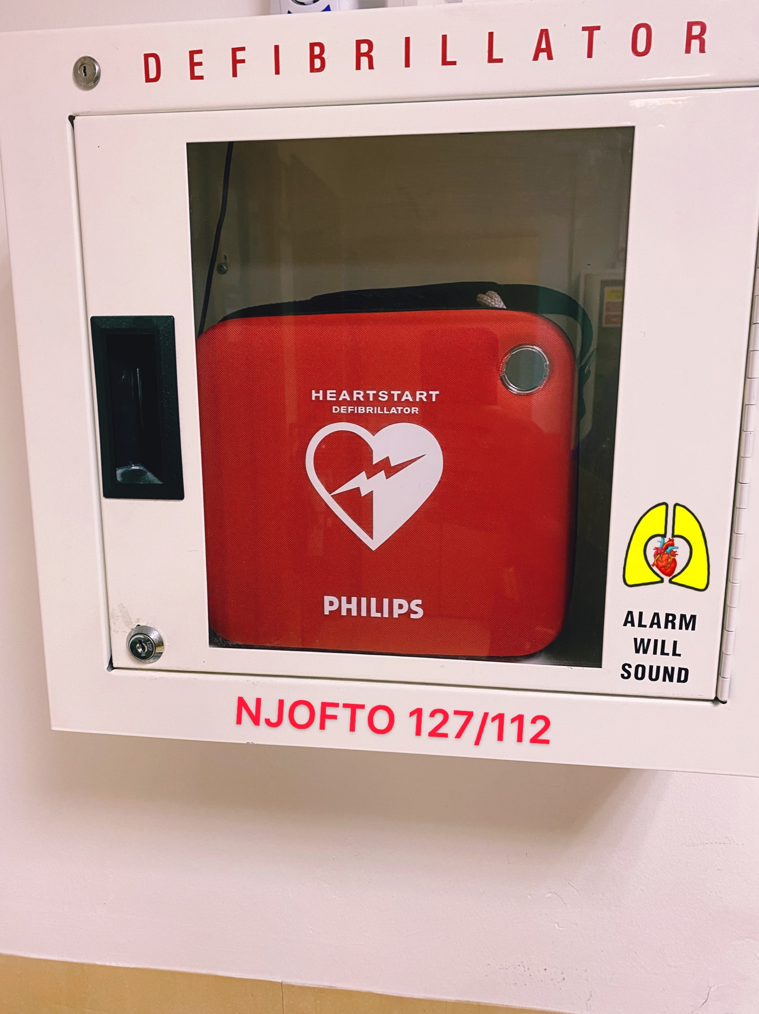 Dy defibrilator te tjere publik vendosen ne Shqiperi per komunitetin